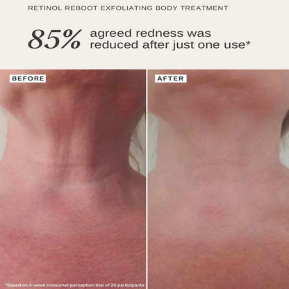 Alpha-H Retinol Reboot Exfoliating Body Treatment with 1% Encapsulated Retinol