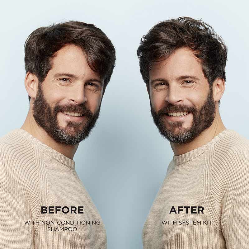 Nioxin System 2 Scalp Revitaliser Conditioner